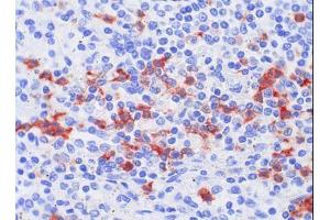 Image no. 1 for anti-S100 Calcium Binding Protein A8 (S100A8) antibody (ABIN379948) (S100A8 antibody)