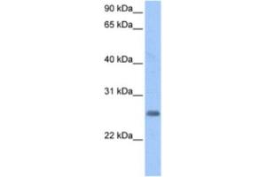 Western Blotting (WB) image for anti-Zinc Finger Protein Pseudogene (LOC728743) antibody (ABIN2463386)