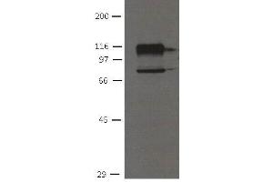 Image no. 1 for anti-Cadherin 11 (CDH11) antibody (ABIN1169677) (OB Cadherin antibody)