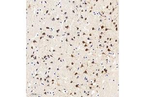 Immunohistochemistry of paraffin embedded mouse brain using MAP9 (ABIN7074622) at dilution of 1:750 (300x lens) (MAP9 antibody)