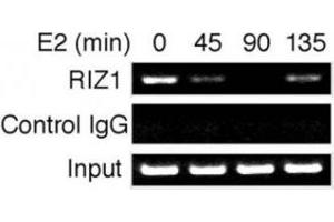 Time course analysis of RIZ1 binding to the pS2 gene promoter. (PRDM2 antibody  (AA 1-347))