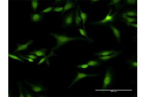 Immunofluorescence of purified MaxPab antibody to SEPT5 on HeLa cell.