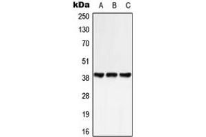 Western blot analysis of GPR25 expression in HeLa (A), NIH3T3 (B), rat spleen (C) whole cell lysates. (GPR25 antibody  (Center))