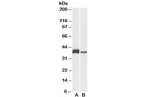 Western blot testing of U937 [A] and human spleen [B] lysates with CAPG antibody at 0. (CAPG antibody)
