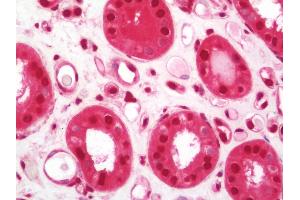 Human Kidney: Formalin-Fixed, Paraffin-Embedded (FFPE) (IKZF2 antibody  (AA 25-75))