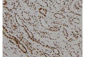ABIN6278699 at 1/100 staining Human kidney tissue by IHC-P. (NR2C1 antibody  (N-Term))