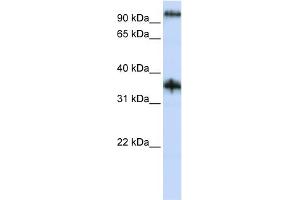 WB Suggested Anti-C9orf4 Antibody Titration:  0. (Ferric-Chelate Reductase 1 Like (FRRS1L) (N-Term) antibody)