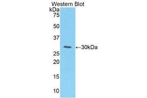 Western Blotting (WB) image for anti-Interleukin-1 Receptor-Associated Kinase 2 (IRAK2) (AA 211-458) antibody (ABIN3206500) (IRAK2 antibody  (AA 211-458))