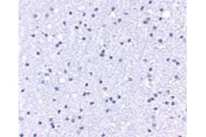 Immunohistochemistry (IHC) image for anti-Anaphase Promoting Complex Subunit 1 (ANAPC1) (C-Term) antibody (ABIN1030243) (APC1 antibody  (C-Term))