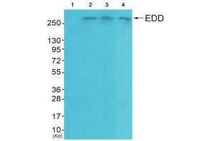 UBR5 antibody