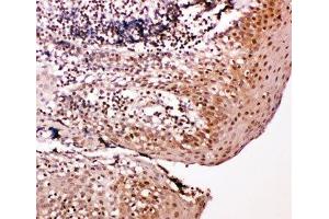 IHC-P: Caspase-14 antibody testing of human tonsil tissue (CASP14 antibody  (AA 223-242))