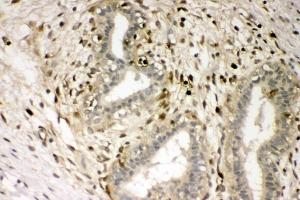 IHC analysis of S100A4 using anti-S100A4 antibody (ABIN7600462). (s100a4 antibody  (AA 2-101))