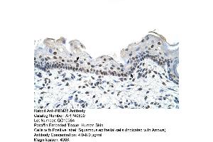 Rabbit Anti-RBM28 Antibody  Paraffin Embedded Tissue: Human Skin Cellular Data: Squamous epithelial cells Antibody Concentration: 4. (RBM28 antibody  (C-Term))