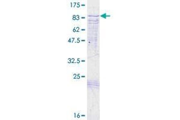 CNKSR3 Protein (AA 1-555) (GST tag)