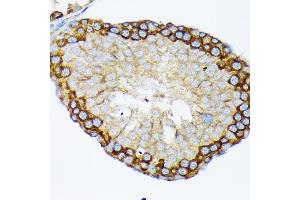 Immunohistochemistry of paraffin-embedded rat testis using USP9X Rabbit mAb (ABIN7271169) at dilution of 1:100 (40x lens). (USP9X antibody)