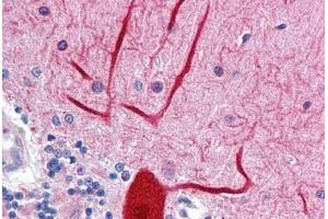 Human Brain, cerebellum: Formalin-Fixed, Paraffin-Embedded (FFPE) (ENPEP antibody  (AA 689-932))