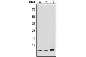 Western blot analysis of MED11 expression in HeLa (A), NIH3T3 (B), PC12 (C) whole cell lysates.