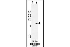 Western blot analysis of CDKN2C using rabbit polyclonal CDKN2C Antibody using 293 cell lysates (2 ug/lane) either nontransfected (Lane 1) or transiently transfected (Lane 2) with the CDKN2C gene.