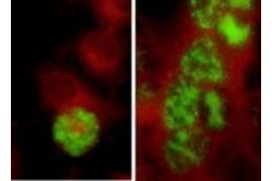 Immunofluorescence (IF) image for anti-Herpes Simplex Virus ICP5 (HSV ICP5) antibody (ABIN265570) (HSV ICP5 antibody)