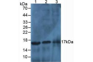 Western blot analysis of (1) Human Liver Tissue, (2) Human Lung Tissue and (3) Human Cartilage Tissue. (HIST3H2A antibody  (AA 1-130))