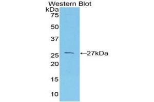 Detection of Recombinant PRNP, Mouse using Polyclonal Antibody to Prion Protein (PRNP)