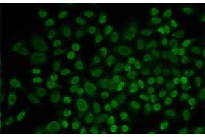 Immunofluorescence analysis of MCF-7 cells using RAD54L2 Polyclonal Antibody (ARIP4 antibody)