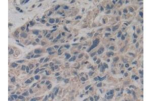 Immunohistochemistry (IHC) image for anti-Slit Homolog 2 (Drosophila) (SLIT2) (AA 1416-1528) antibody (ABIN7438007)