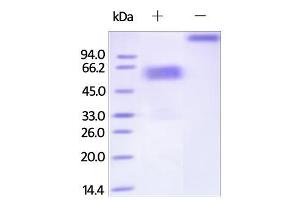 Human TIM-3 (22-200), Fc Tag on SDS-PAGE under reducing (R) condition. (TIM3 Protein (AA 22-200) (Fc Tag))