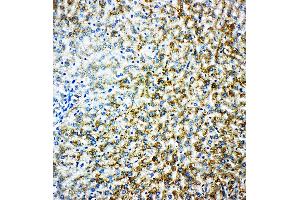 Anti-Monoamine Oxidase B antibody, IHC(P) IHC(P): Rat Liver Tissue (Monoamine Oxidase B antibody  (N-Term))