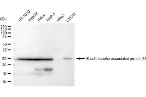 Western blotting analysis using B cell receptor associated protein 31 antibody (ABIN7797723).