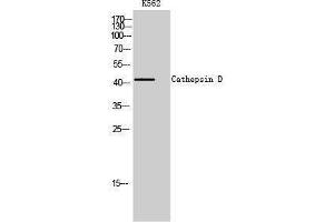 Western Blotting (WB) image for anti-Cathepsin D (CTSD) (Internal Region) antibody (ABIN3181789) (Cathepsin D antibody  (Internal Region))