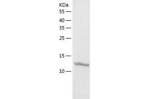 Podoplanin Protein (PDPN) (AA 23-141) (His tag)