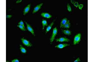 Immunofluorescent analysis of Hela cells using ABIN7162969 at dilution of 1:100 and Alexa Fluor 488-congugated AffiniPure Goat Anti-Rabbit IgG(H+L) (PEX11B antibody  (AA 9-228))