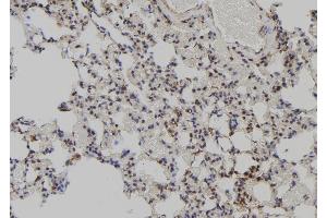 ABIN6272516 at 1/100 staining Rat lung tissue by IHC-P. (MAGED2 antibody  (N-Term))