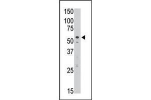 The anti-DSiglec C-term  Pab (ABIN388430 and ABIN2837866) is used in Western blot to detect DSiglec in Jurkat cell lysate. (SIGLEC7 antibody  (C-Term))