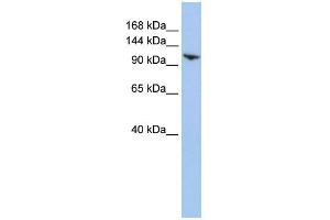 WB Suggested Anti-RNF20 Antibody Titration:  0. (RNF20 antibody  (N-Term))