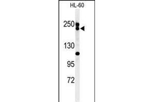 Western blot analysis of BLM Antibody (C-term) (ABIN651053 and ABIN2840049) in HL-60 cell line lysates (35 μg/lane). (BLM antibody  (C-Term))