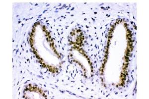 IHC analysis of KDM5B using anti-KDM5B antibody (ABIN4886648). (KDM5B antibody  (Middle Region))