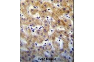 KT Antibody (C-term) (ABIN655129 and ABIN2844756) immunohistochemistry analysis in formalin fixed and paraffin embedded human liver tissue followed by peroxidase conjugation of the secondary antibody and DAB staining. (KRTCAP2 antibody  (C-Term))