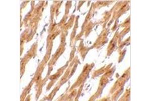 Immunohistochemistry of ASAH1 in human heart tissue with ASAH1 antibody at 2. (ASAH1 antibody  (C-Term))