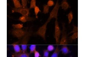 Immunofluorescence analysis of NIH-3T3 cells using VPS26A Polyclonal Antibody at dilution of 1:100 (40x lens). (VPS26A antibody)