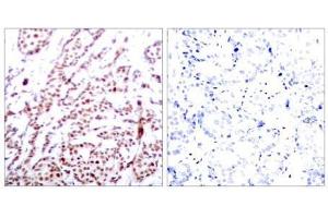 Image no. 1 for anti-Activating Transcription Factor 2 (ATF2) (pThr55), (pThr73) antibody (ABIN196668) (ATF2 antibody  (pThr55, pThr73))