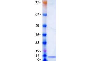 Western Blotting (WB) image for Guanylate Cyclase Activator 2B (Uroguanylin) (GUCA2B) protein (Myc-DYKDDDDK Tag) (ABIN2722375)