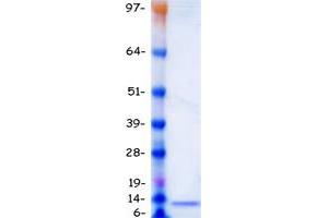 Validation with Western Blot (GUCA2B Protein (Myc-DYKDDDDK Tag))