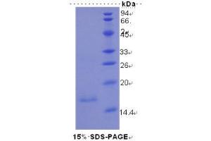 SDS-PAGE (SDS) image for Mucin 5 Subtype B (MUC5B) (AA 5366-5444) protein (His tag) (ABIN1080325)