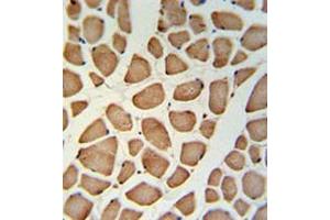 Immunohistochemistry analysis in skeletal muscle (Formalin-fixed, Paraffin-embedded) using TECR / GPSN2  Antibody (C-term), followed by peroxidase conjugation of the secondary antibody and DAB staining. (TECR antibody  (C-Term))