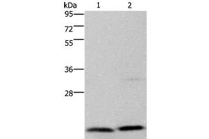 Western Blot analysis of Jurkat and PC3 cell using MCTS1 Polyclonal Antibody at dilution of 1:200 (MCTS1 antibody)