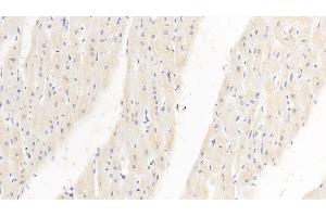 Detection of PDL1 in Human Cardiac Muscle Tissue using Monoclonal Antibody to Programmed Cell Death Protein 1 Ligand 1 (PDL1) (PD-L1 antibody  (AA 24-234))