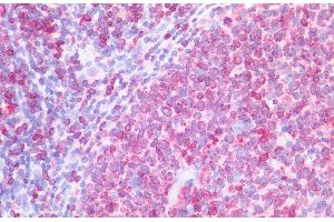ABIN2613403 (5 μg/mL) staining of paraffin embedded Human Tonsil. (CD74 antibody  (Internal Region))
