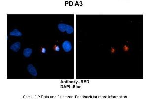 Immunohistochemistry (IHC) image for anti-Protein Disulfide Isomerase Family A, Member 3 (PDIA3) (C-Term) antibody (ABIN2774375)